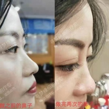 尋夢(mèng)緣美業(yè) 針灸 微整 零成本助你創(chuàng)造百萬(wàn)業(yè)績(jī)