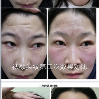 尋夢(mèng)緣美業(yè) 中醫(yī)美容 針灸微整 技術(shù)培訓(xùn)中心