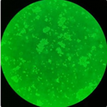 智立中特生物人卵巢癌細(xì)胞OVCA433