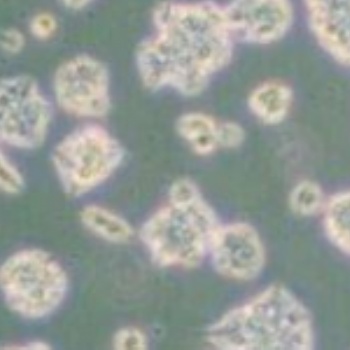 人支氣管上皮細(xì)胞HBEpiC質(zhì)粒載體網(wǎng)zl-043983