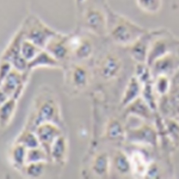 Neuro-2a+Luc 小鼠腦神經(jīng)瘤細(xì)胞熒光素酶標(biāo)記